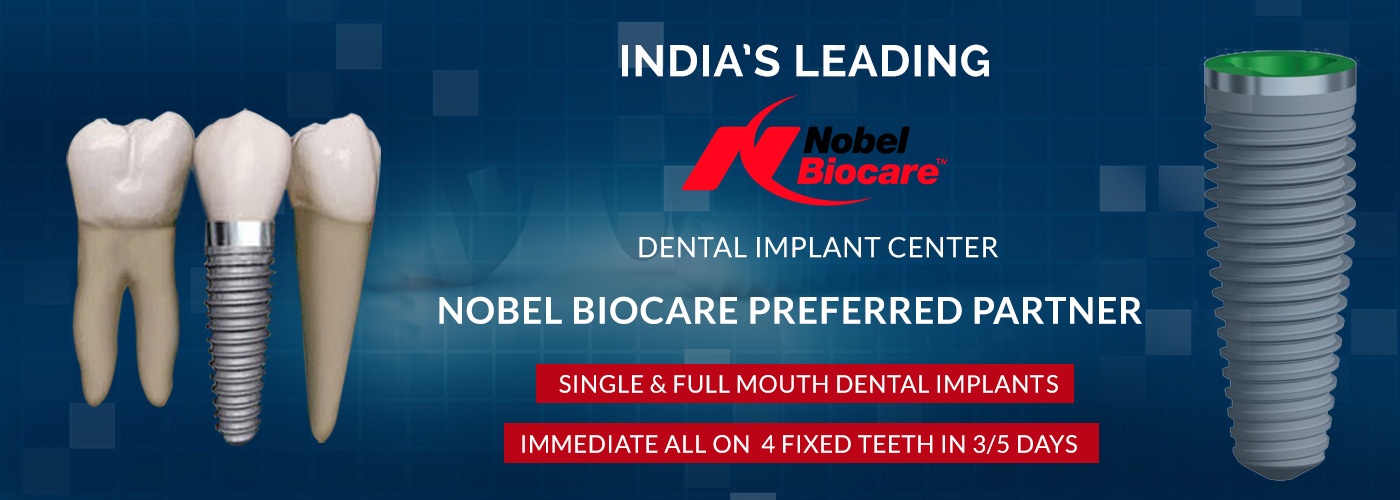 Best Dental Implants Hospital in Hyderabad Top Dental Clinics in