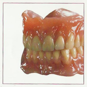 Removable Implant Dentures