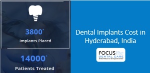 Cost of tooth implants in Hyderabad , India