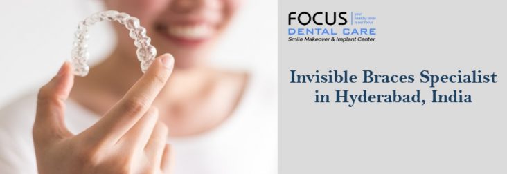 Invisible Braces Specialist in Hyderabad