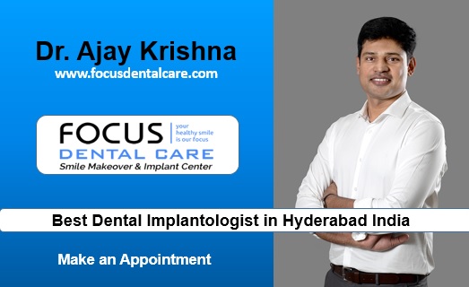 dr. ajay krishna best dental implantologist in hyderabad india