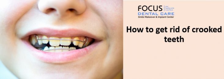how to prevent crooked teeth