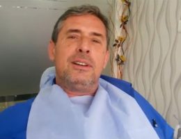 Full Mouth Dental Implant Mr. Frank (Kazan, Russia)