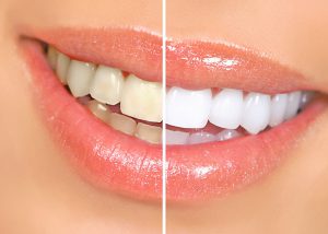 Best Dentist in Hyderabad