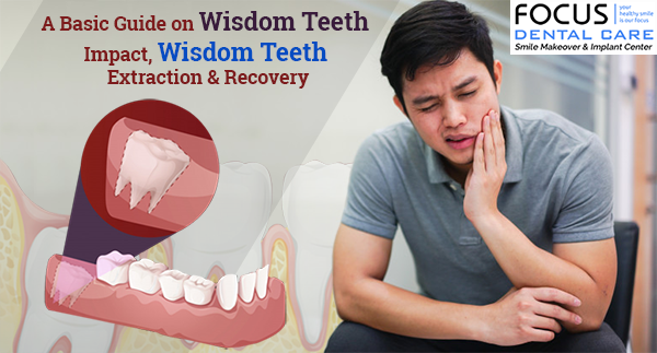 wisdom tooth extraction in hyderabad