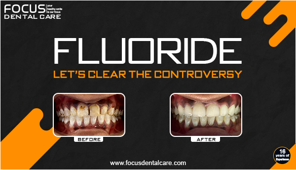 Understanding How Fluoride Helps Prevent and Repair Tooth