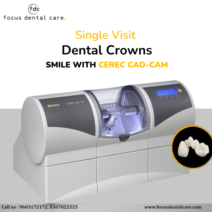 Dental-crowns-in-Hyderabad