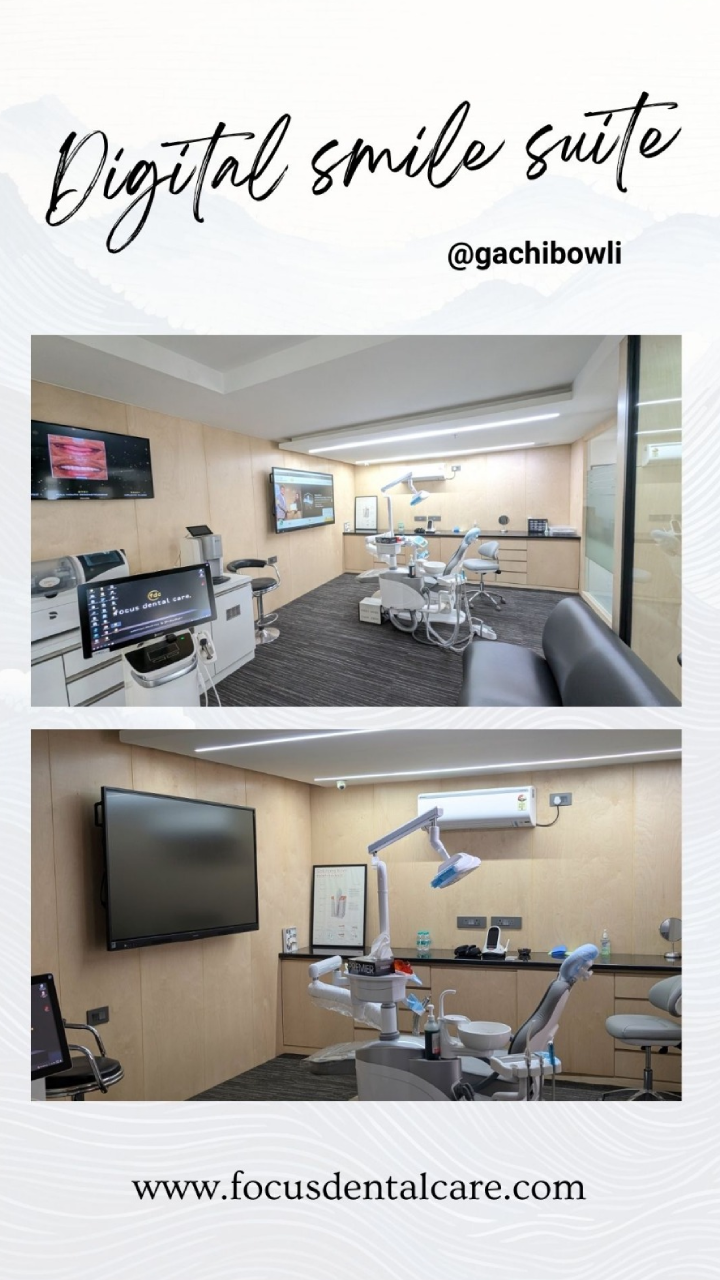 Luxurious smile design suite in Hyderabad Best Digital Smile Designing Clinic in Hyderabad | Focus Dental Care Gachibowli